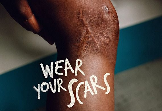 Hockey India & Capri Sports Launch 'Wear Your Scars' Campaign